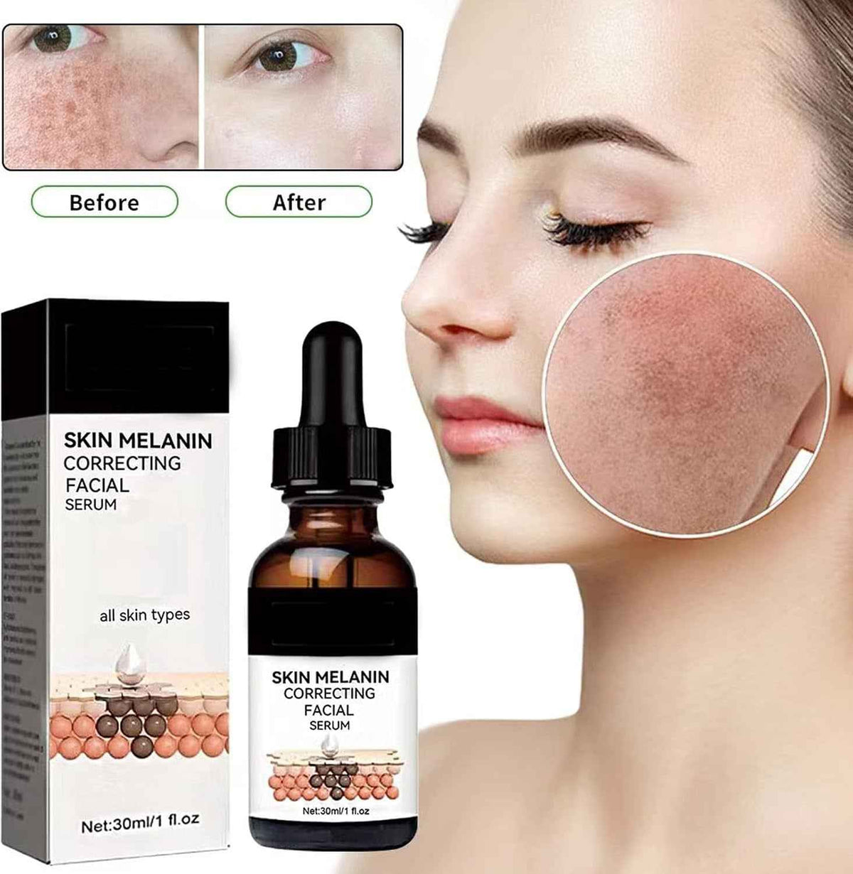 Melanin Correcting Facial Serum (50 ml)