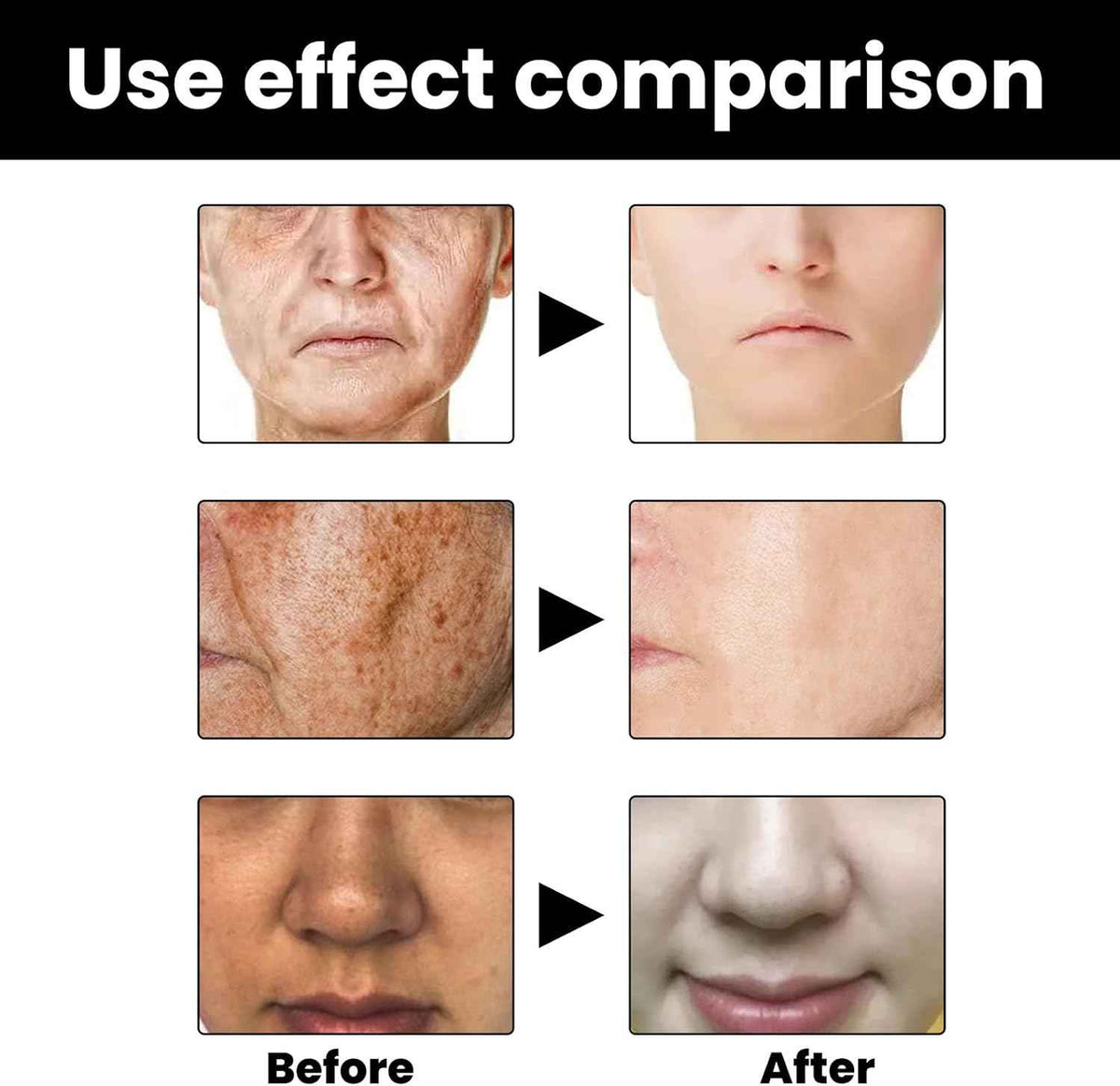 Melanin Correcting Facial Serum (50 ml)